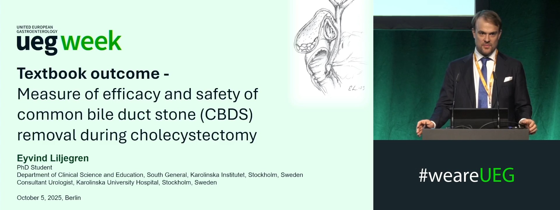 TEXTBOOK OUTCOME – MEASURE OF EFFICACY AND SAFETY USED TO COMPARE METHODS OF COMMON BILE DUCT STONE (CBDS) REMOVAL DURING CHOLECYSTECTOMY IN POPULATION BASED PROSPECTIVE COHORT STUDY