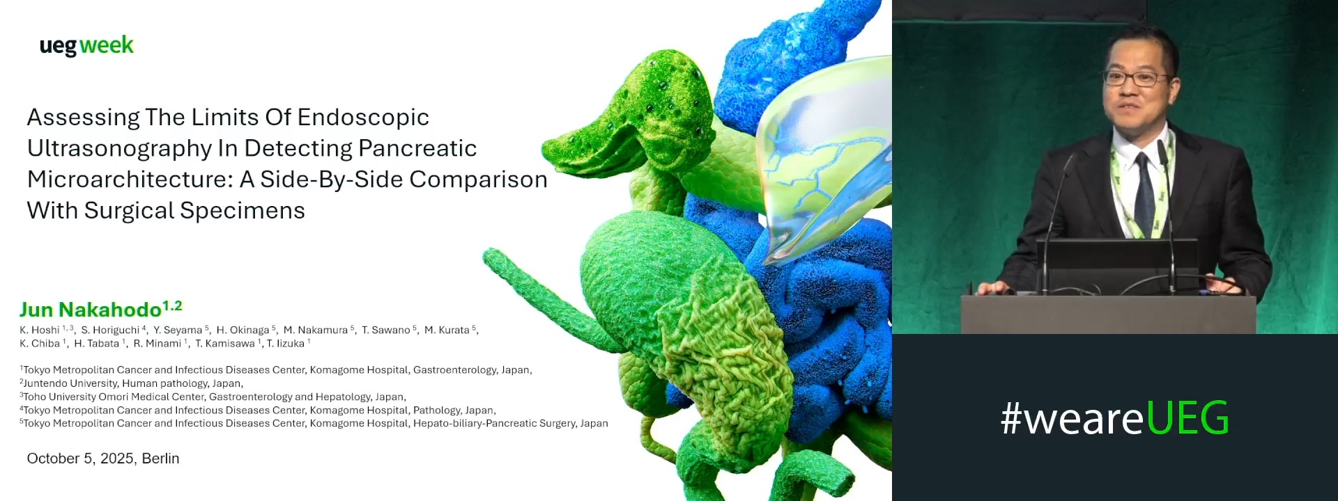 ASSESSING THE LIMITS OF ENDOSCOPIC ULTRASONOGRAPHY IN DETECTING PANCREATIC MICROARCHITECTURE: A SIDE-BY-SIDE COMPARISON WITH SURGICAL SPECIMENS
