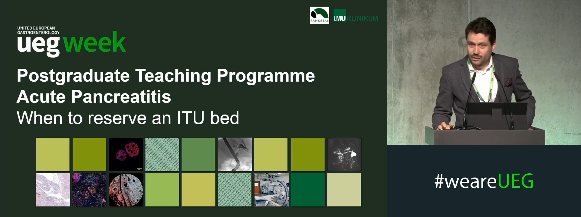 Acute pancreatitis: When to reserve an ITU bed?