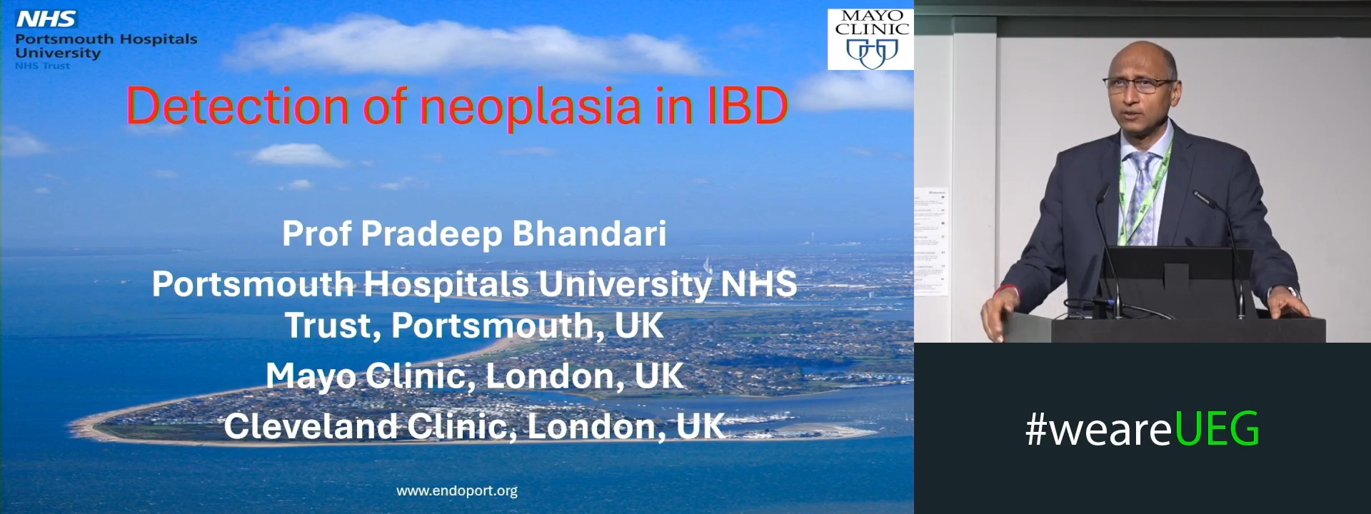 Surveillance endoscopy in IBD: A role for AI?