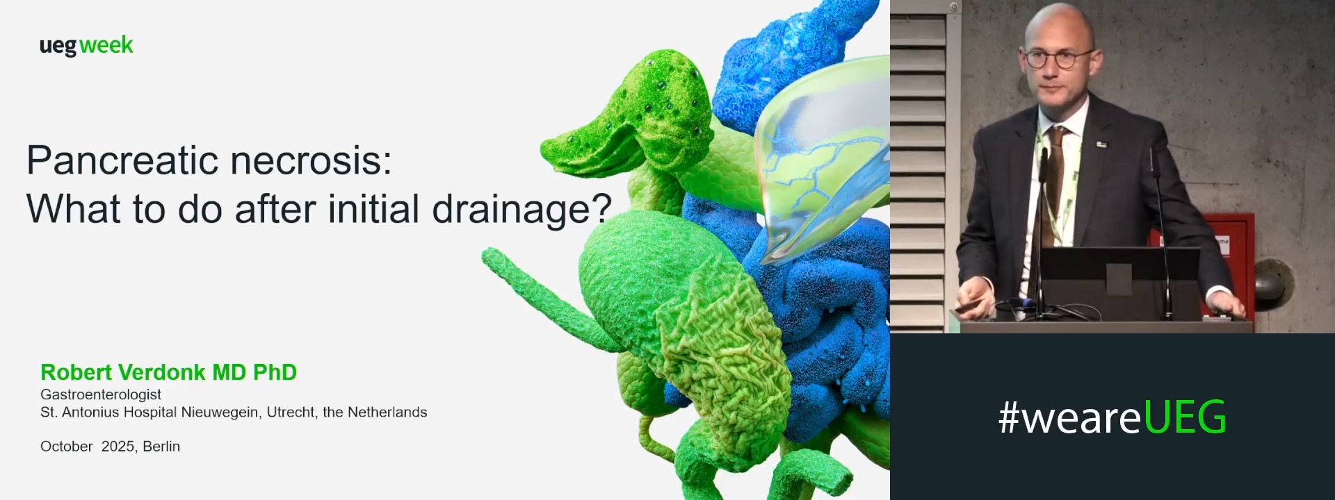 Pancreas necrosis: What to do after initial drainage