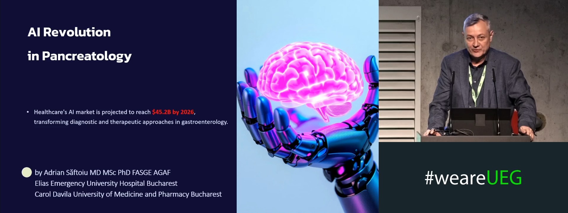 Artifical intelligence in pancreatic imaging