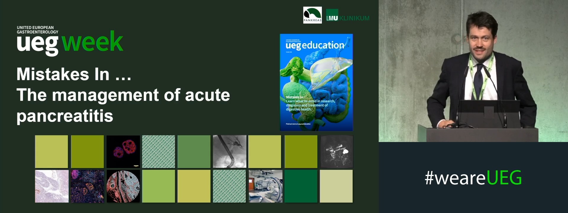 The management of acute pancreatitis