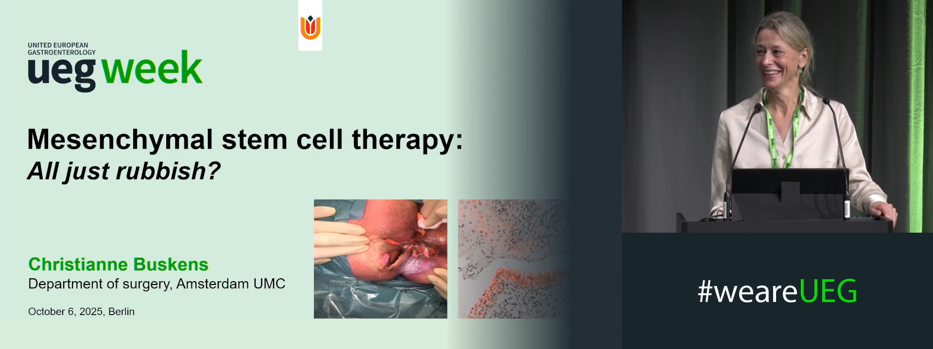 Mesenchymal stem cell therapy: All just rubbish?