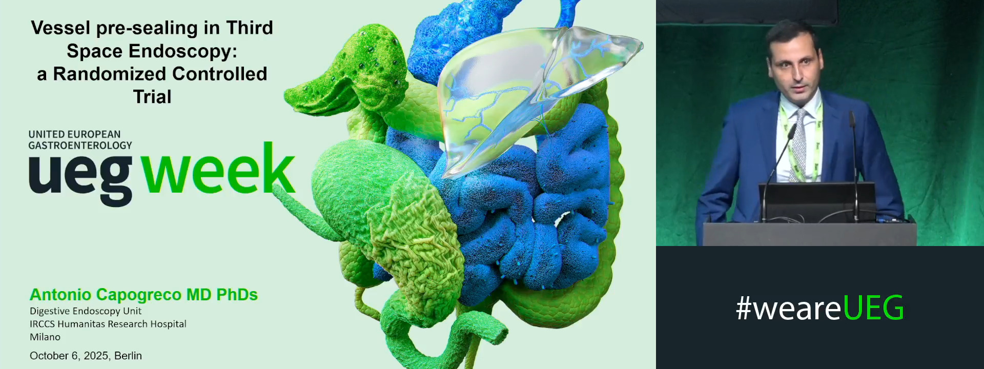 VESSEL PRE-SEALING IN THIRD SPACE ENDOSCOPY: A RANDOMIZED CONTROLLED TRIAL