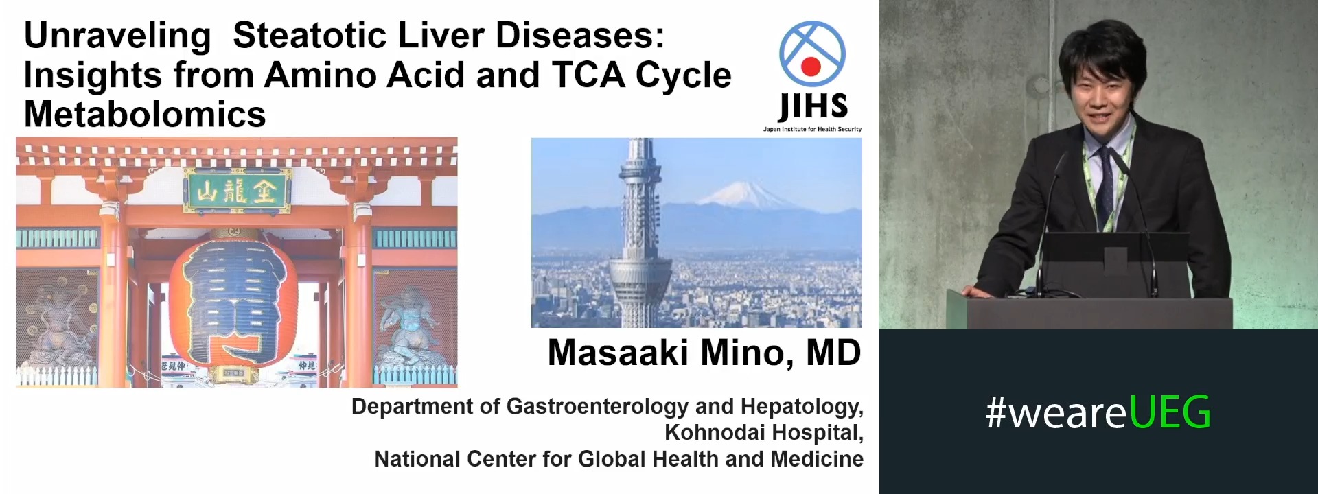 Unraveling Steatotic Liver Diseases: Insights from Amino Acid and TCA Cycle Metabolomics
