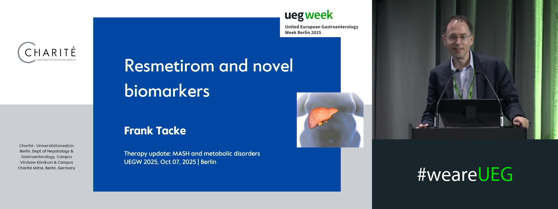 Resmetirom and novel biomarkers