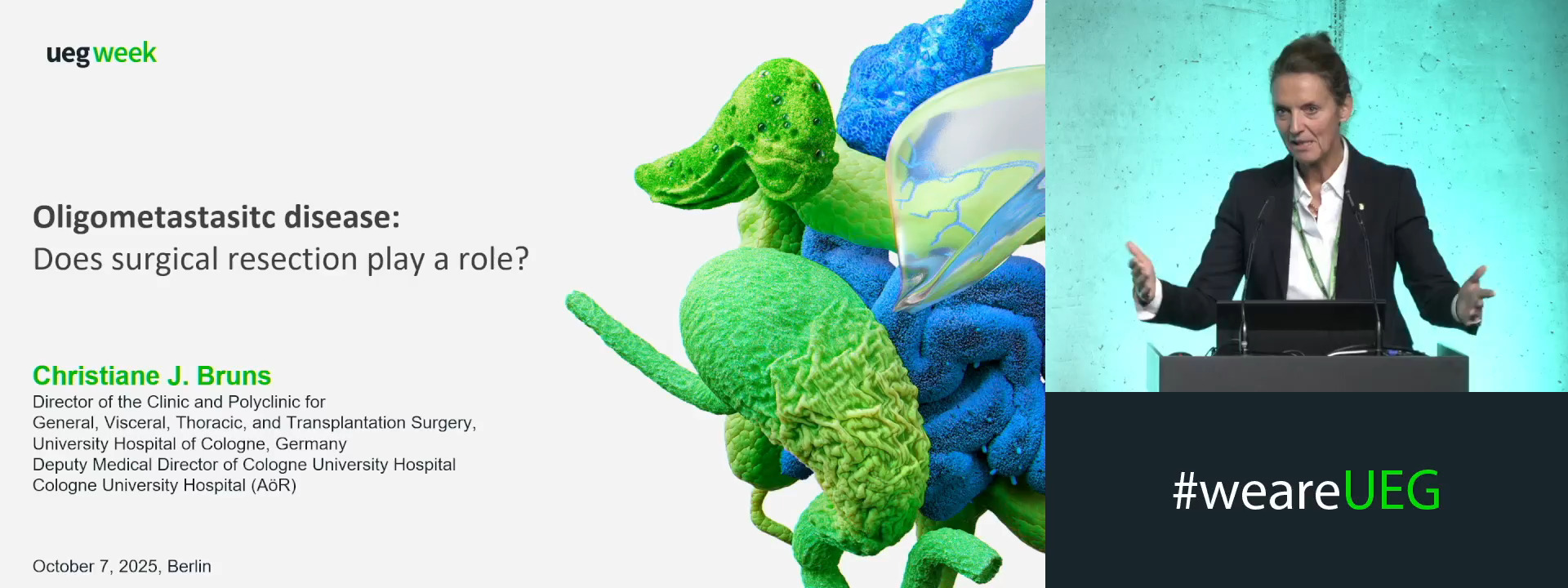 Oligometastasitc disease: Does surgical resection play a role?