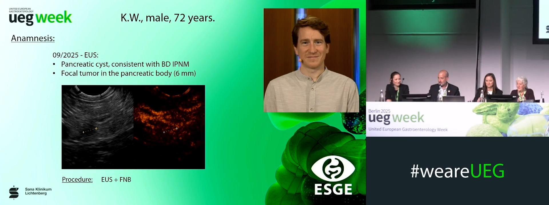 ESGE Live Endoscopy II (Complete Session)