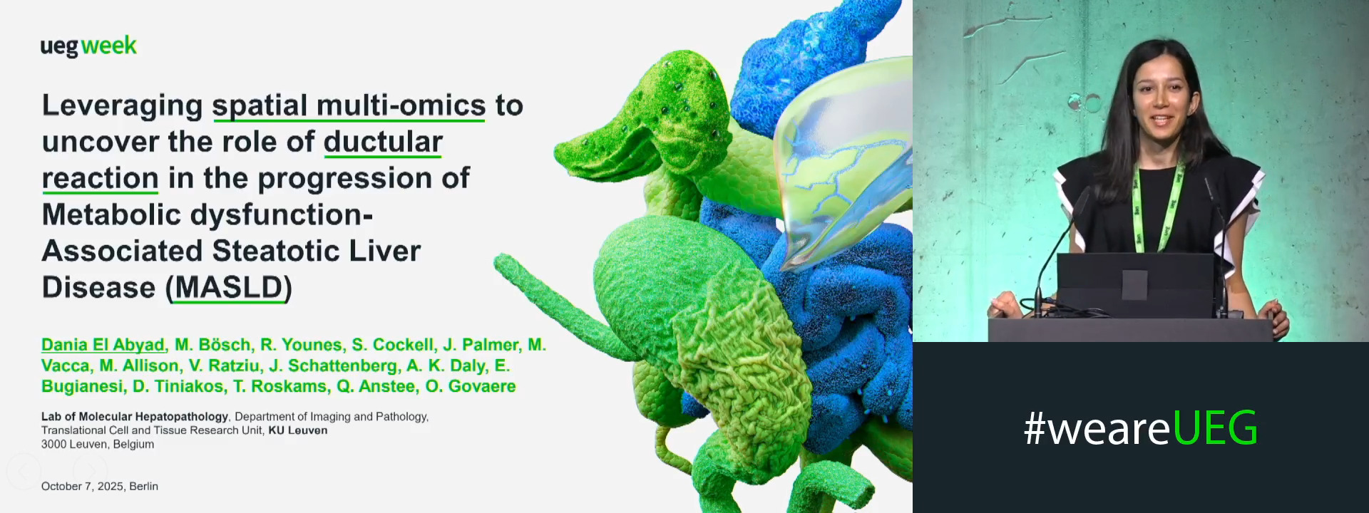 LEVERAGING SPATIAL MULTI-OMICS TO UNCOVER THE ROLE OF DUCTULAR REACTION IN THE PROGRESSION OF METABOLIC DYSFUNCTION-ASSOCIATED STEATOTIC LIVER DISEASE