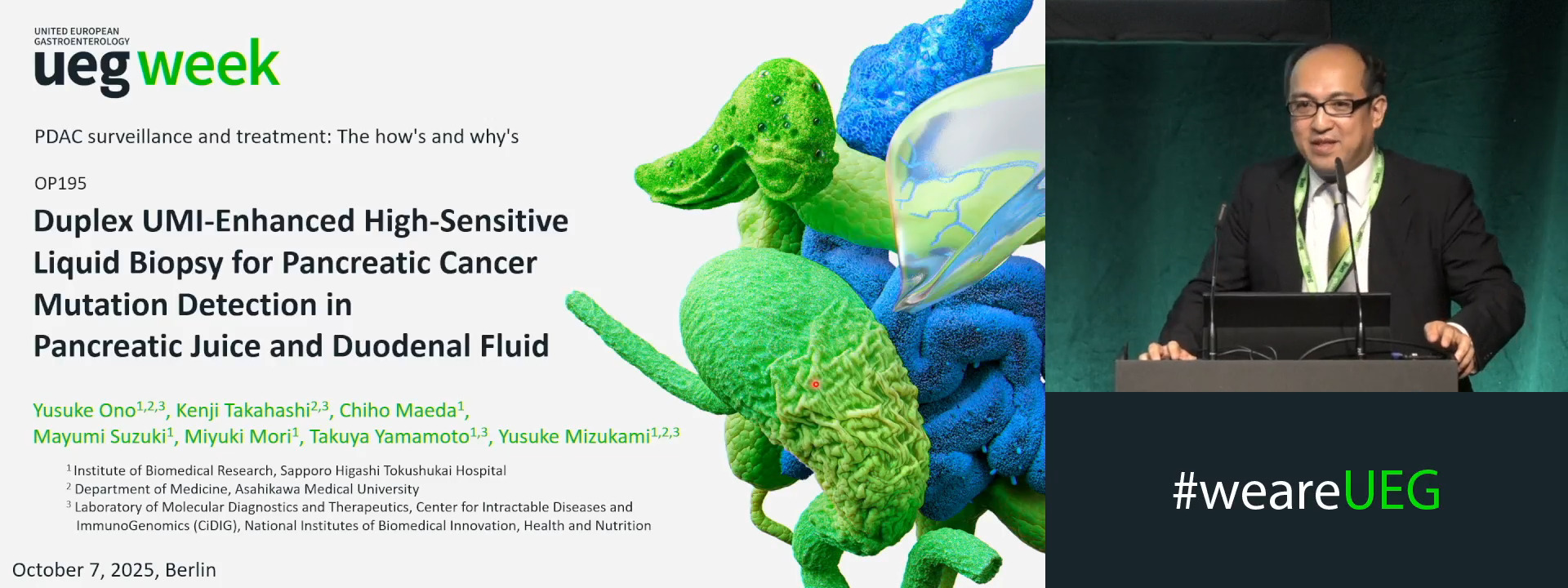 DUPLEX UMI-ENHANCED HIGH-SENSITIVE LIQUID BIOPSY FOR PANCREATIC CANCER MUTATION DETECTION IN PANCREATIC JUICE AND DUODENAL FLUID