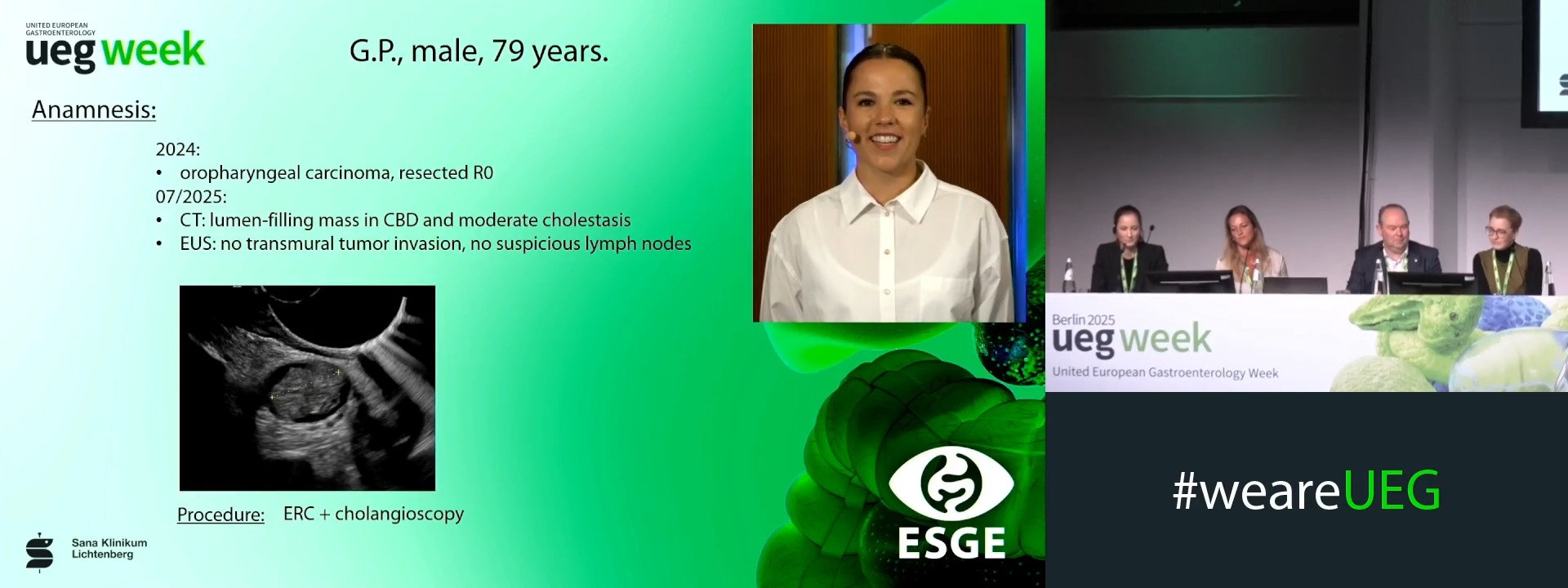 ESGE Live Endoscopy III (Complete Session)