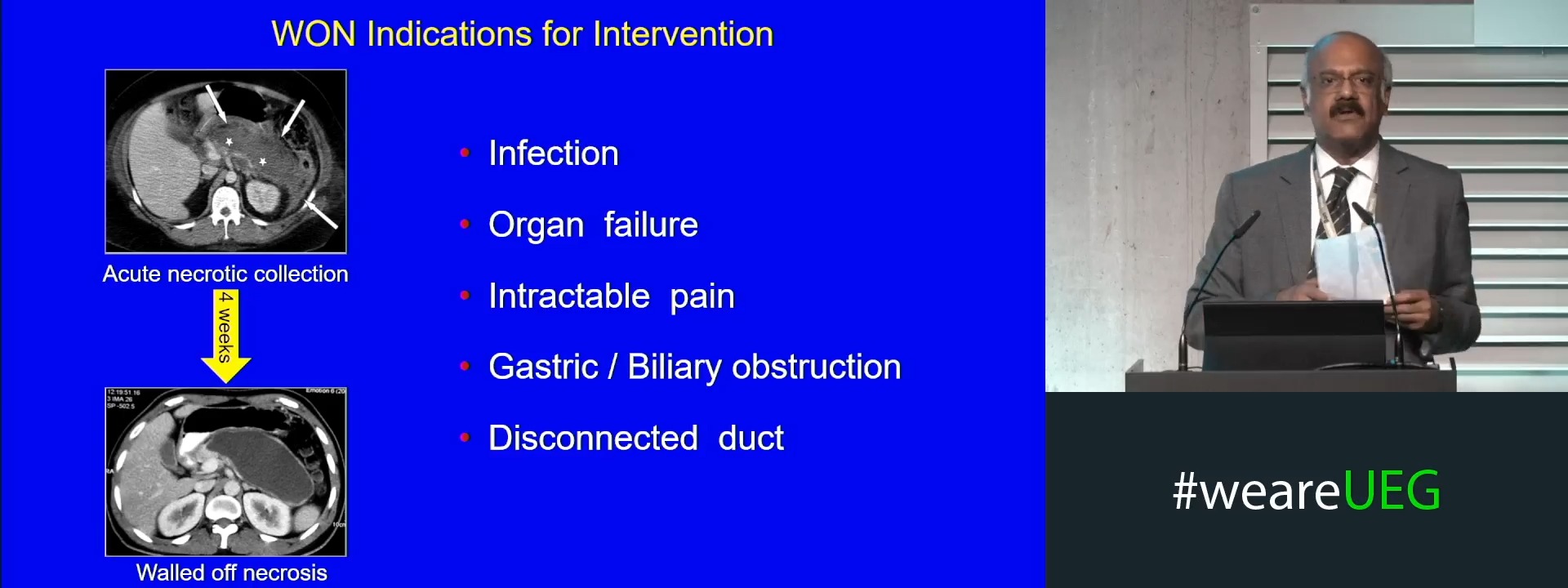 Early versus delayed endoscopic necrosectomy (Complete Session)