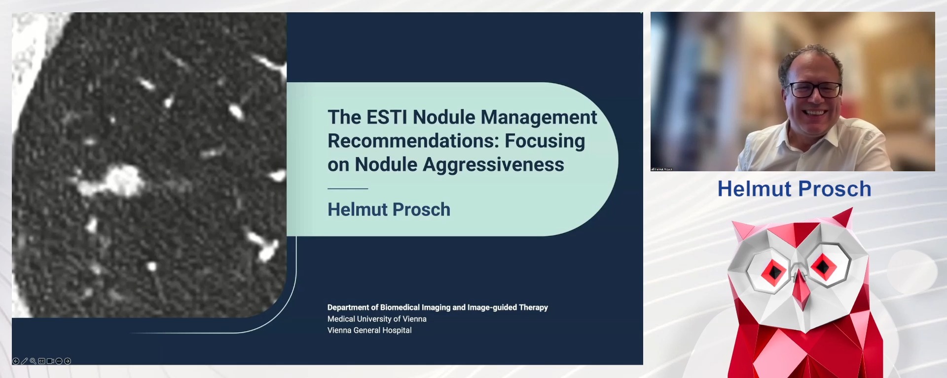 The ESTI nodule management recommendations: focusing on nodule aggressiveness