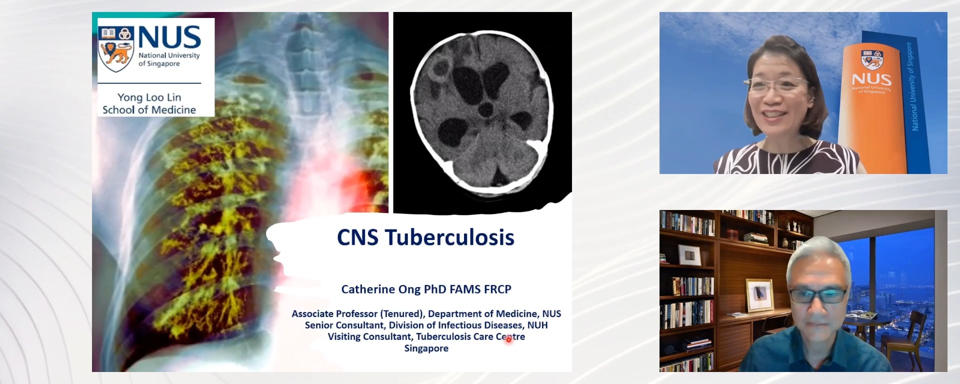 Central Nervous System Tuberculosis