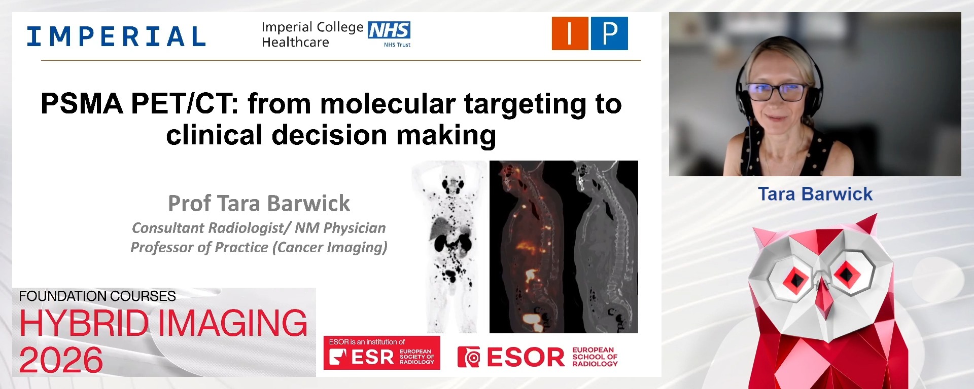 PSMA PET/CT: From Molecular Targeting to Clinical Decision-Making