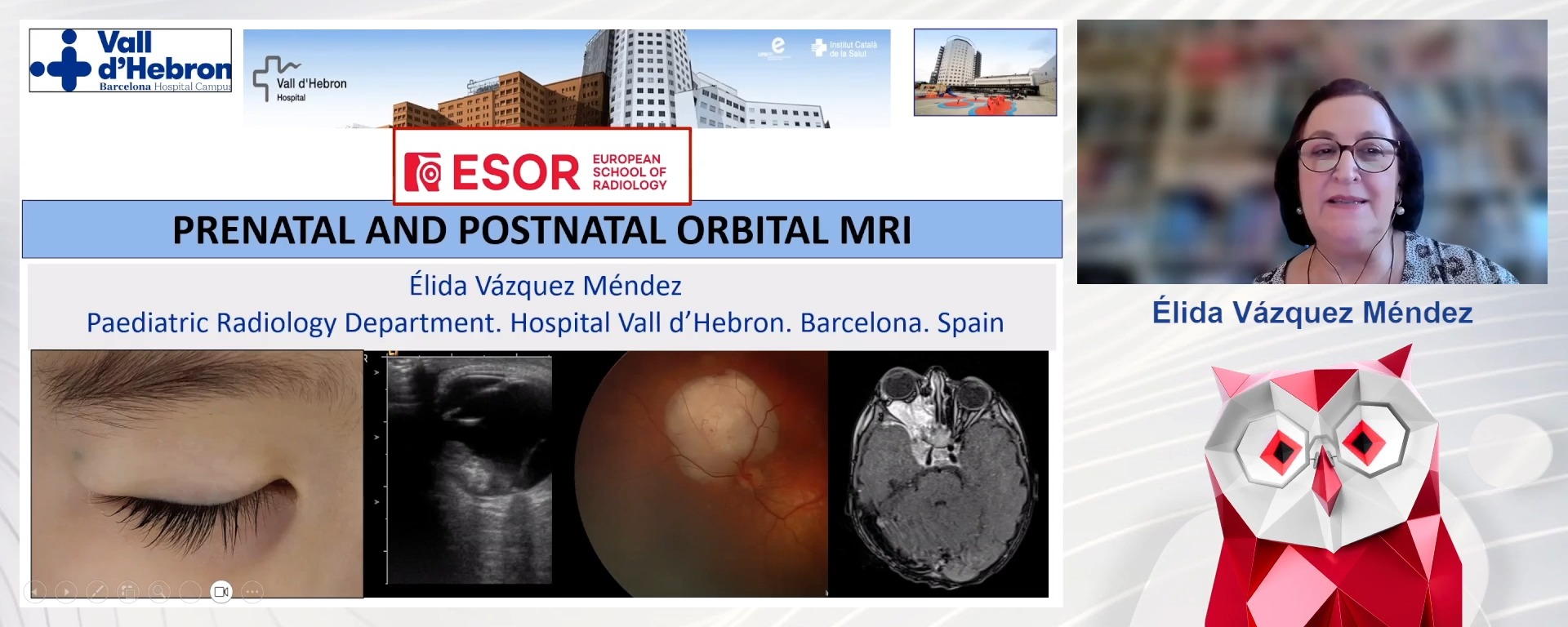Prenatal and Postnatal Orbital MRI