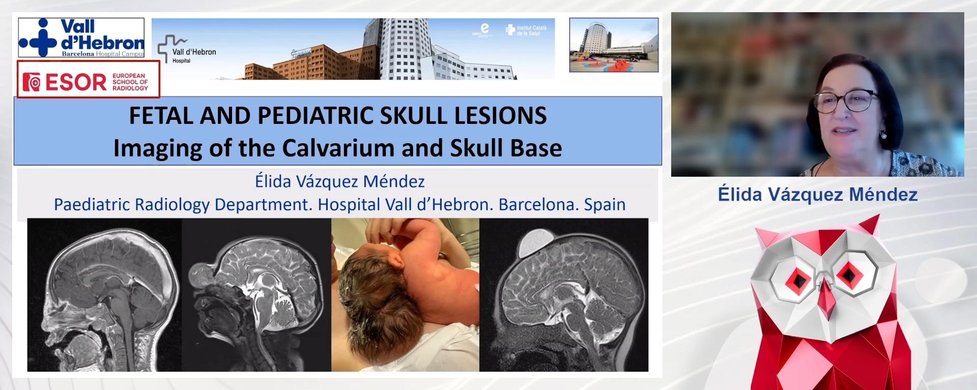 Fetal and Pediatric Skull Lesions: Imaging of the Calvarium and Skull Base