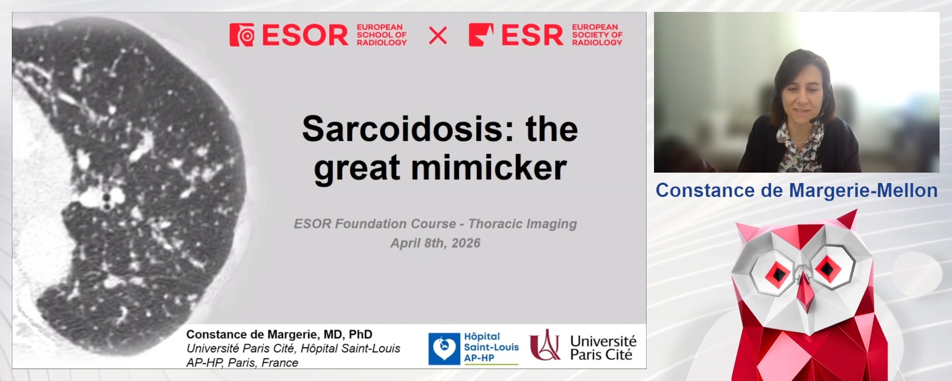 Sarcoidosis as the Great Mimicker