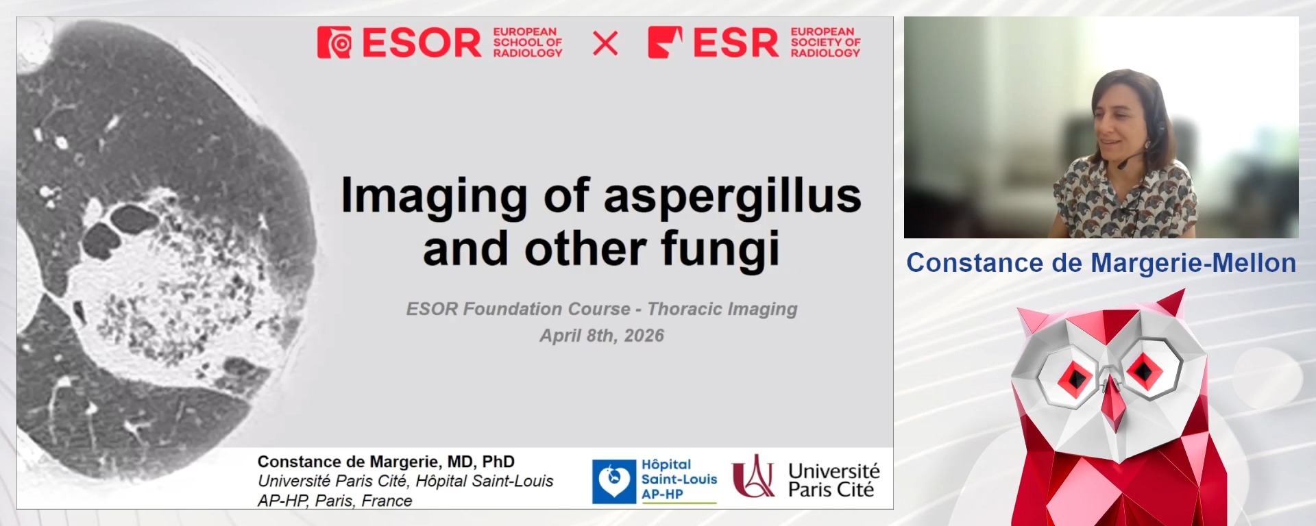 Imaging of Aspergillus and Other Fungi