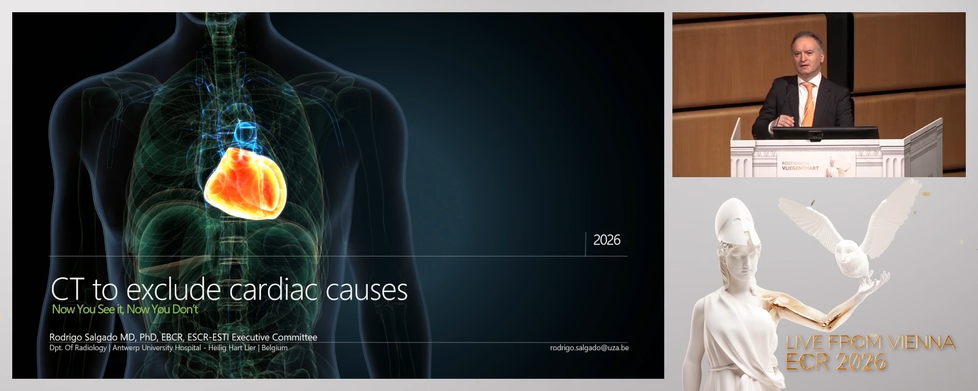 CT to exclude cardiac causes?