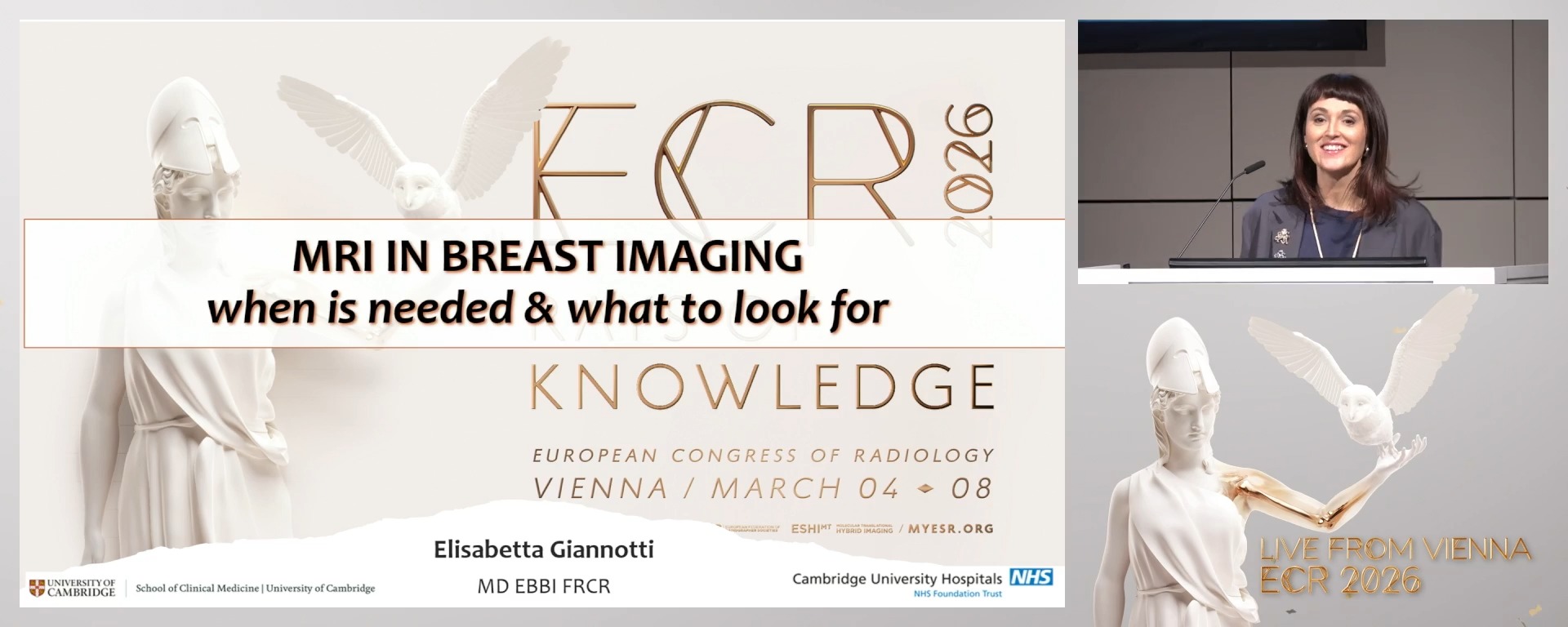 MRI in breast imaging: when is it needed and what to look for?
