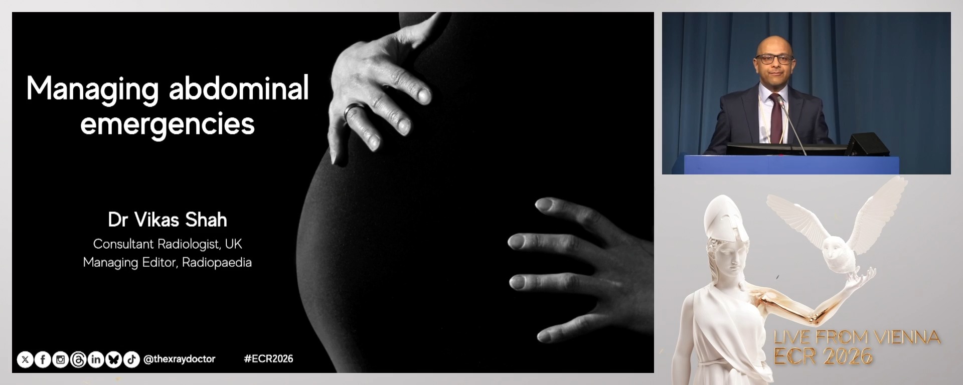 Managing abdominal emergencies