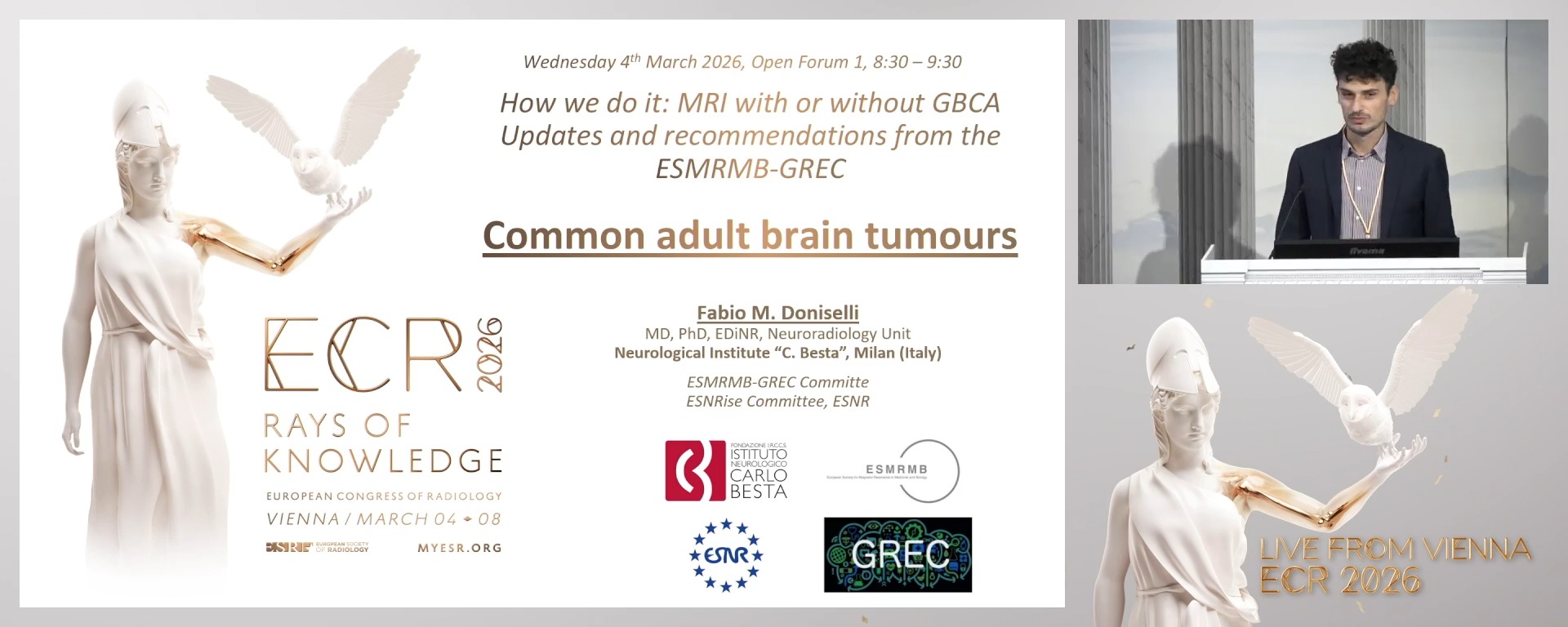 Common adult brain tumours