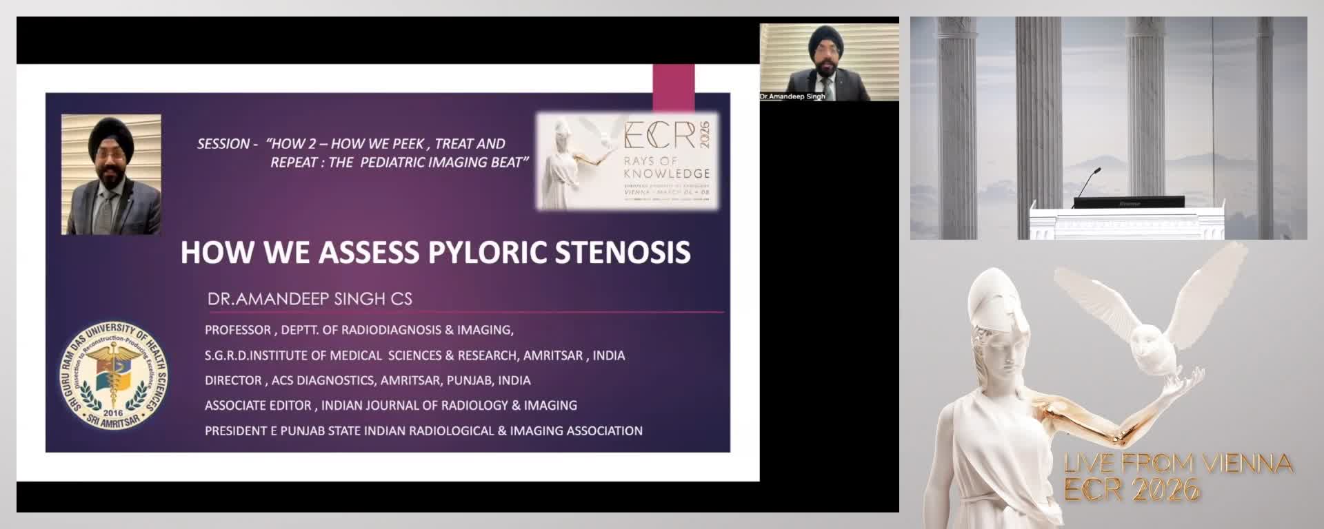 How we assess pyloric stenosis