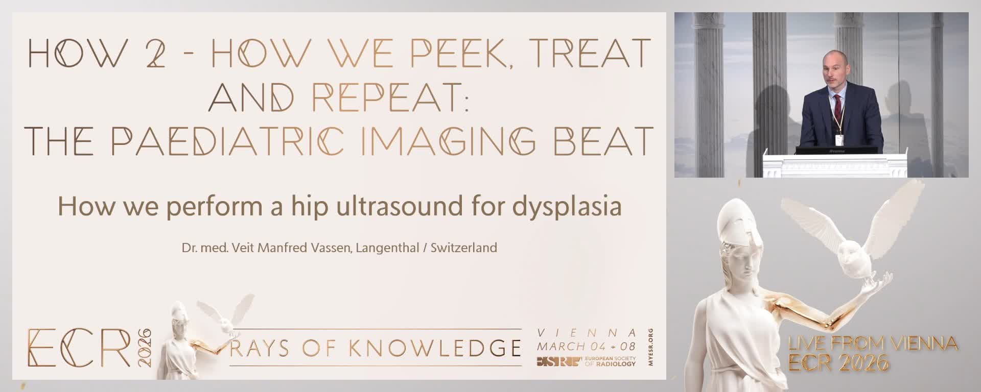 How we perform a hip ultrasound for dysplasia
