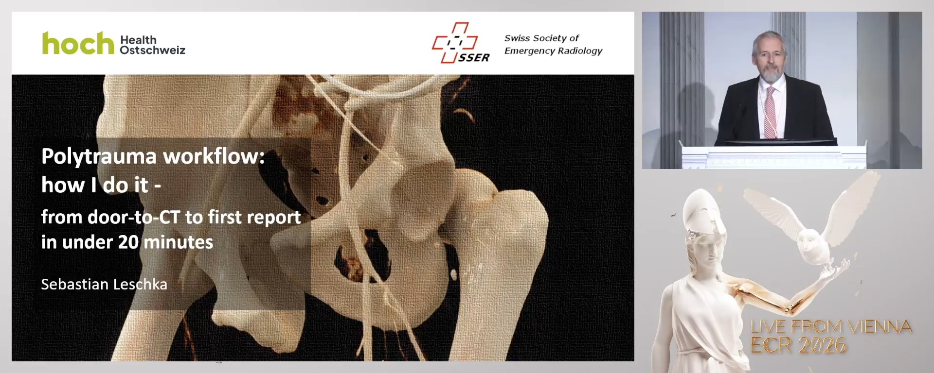 Polytrauma workflow: how I do it - from door-to-CT to first report in under 20 minutes