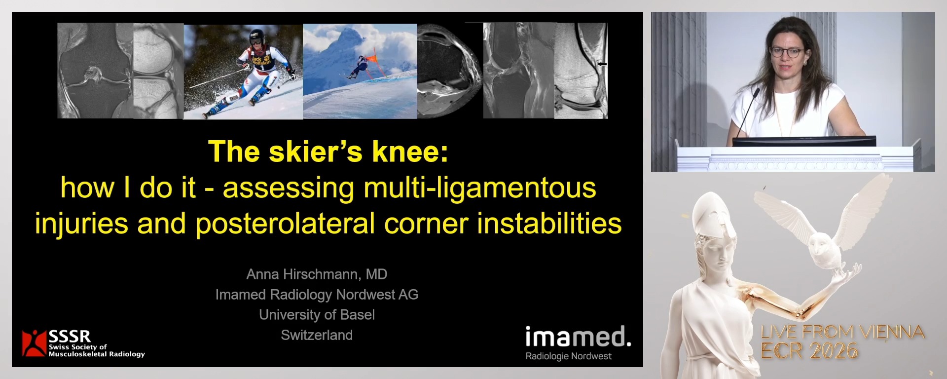 The skier’s knee: how I do it - assessing multi-ligamentous injuries and posterolateral corner instabilities