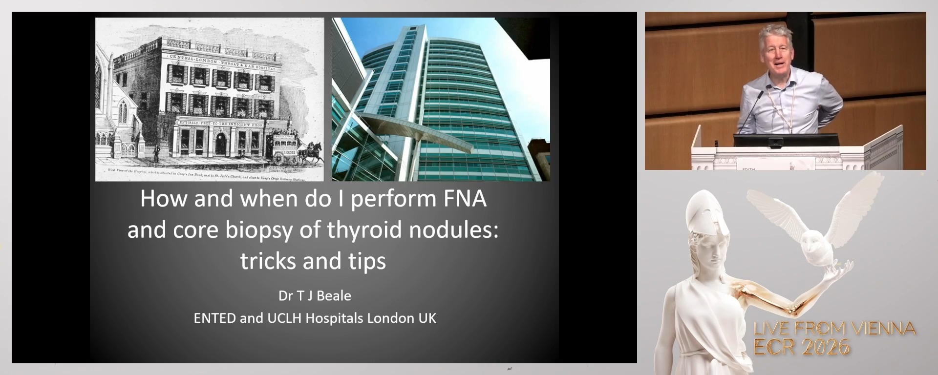 How and when do I perform FNA and core biopsy of thyroid nodules: tricks and tips