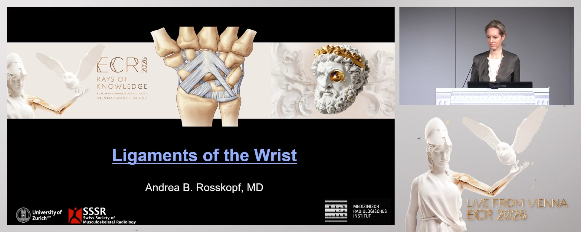 Ligaments of the wrists