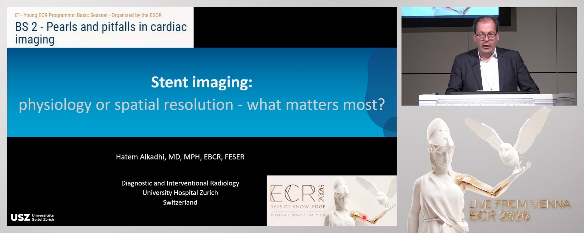 Stent imaging: physiology or spatial resolution: what matters most?