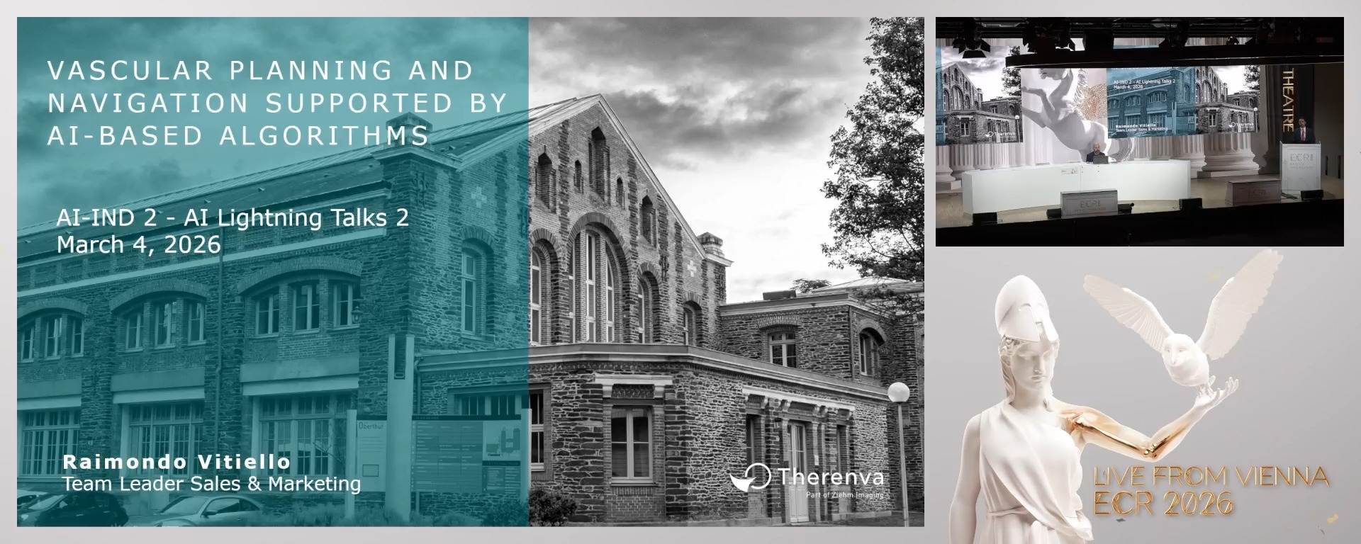 Vascular planning and navigation supported by AI-based algorithms