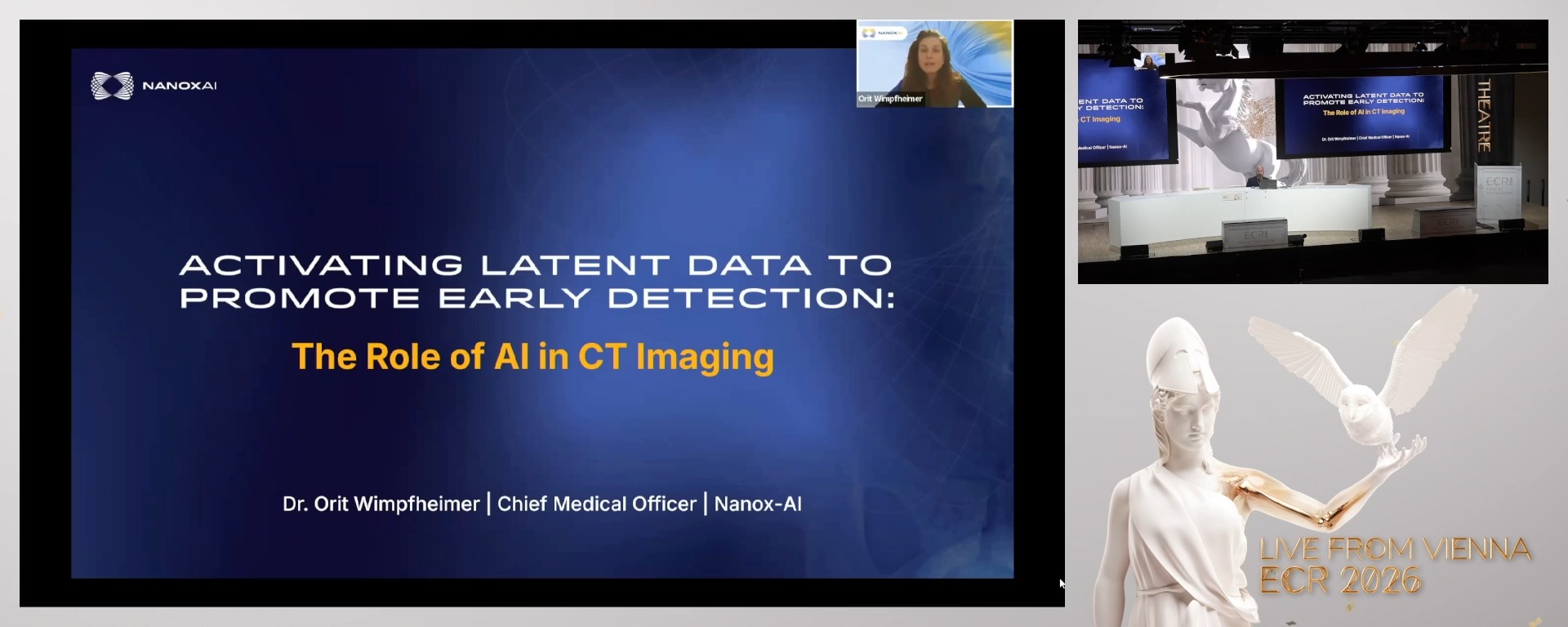 Activating Latent Data to Promote Early Detection: The Role of AI in CT Imaging
