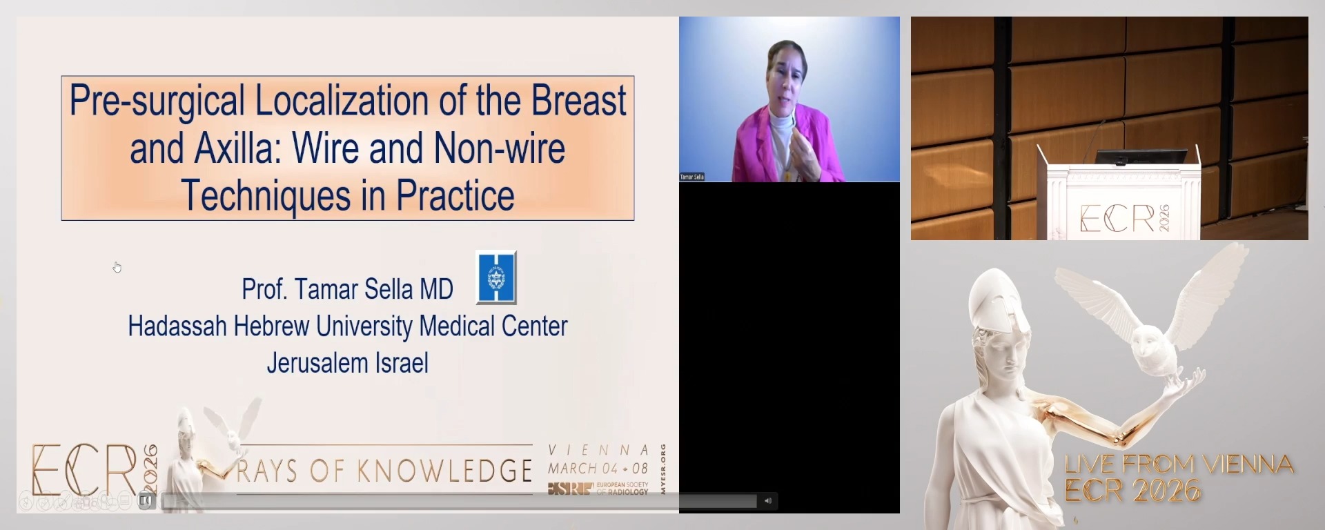 Pre-surgical localisation of the breast and axilla: wire and non-wire techniques in practice