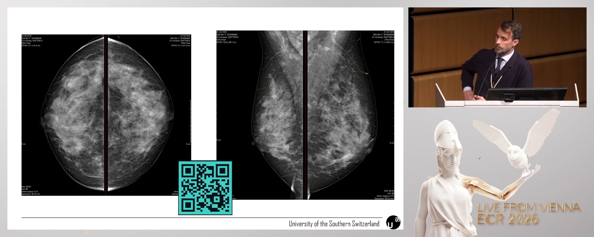 Panel discussion: When the guidelines end: navigating grey zones in breast imaging
