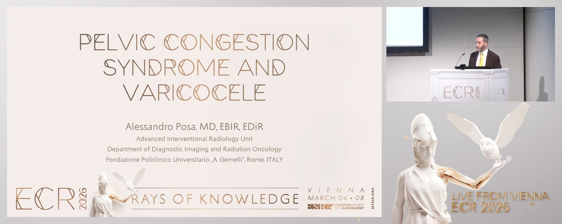 Pelvic congestion syndrome and varicocele