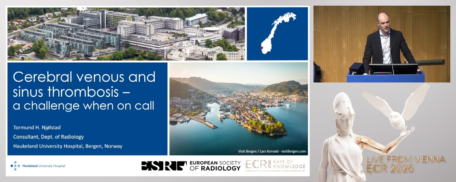 Cerebral venous and sinus thrombosis: a challenge when on call