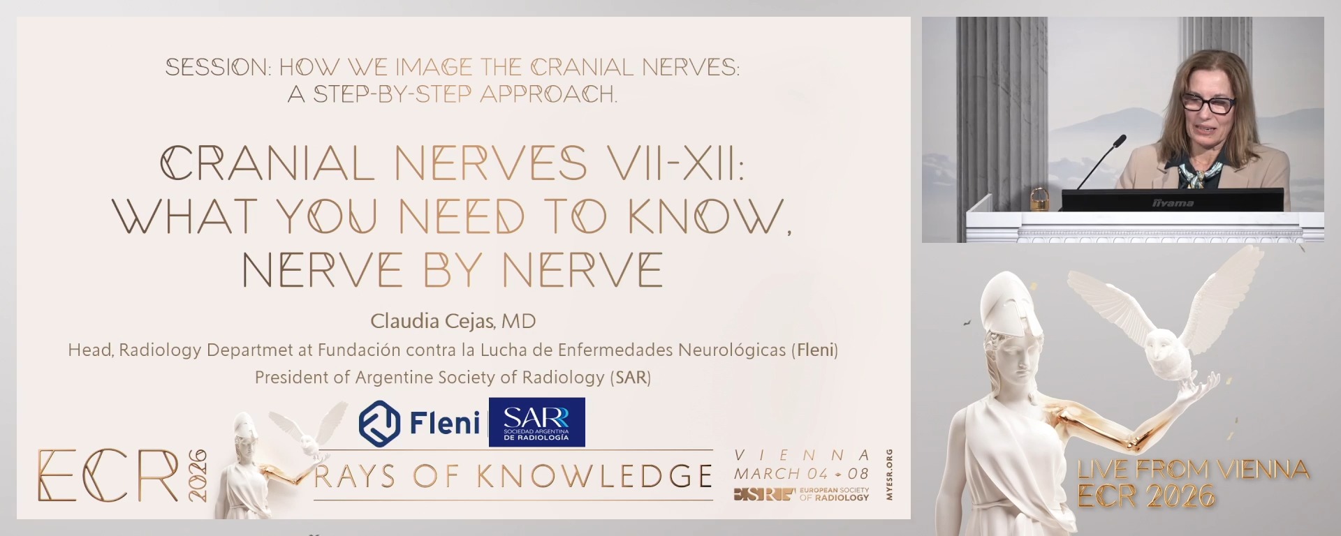 Cranial Nerves VII-XII: what you need to know, nerve by nerve