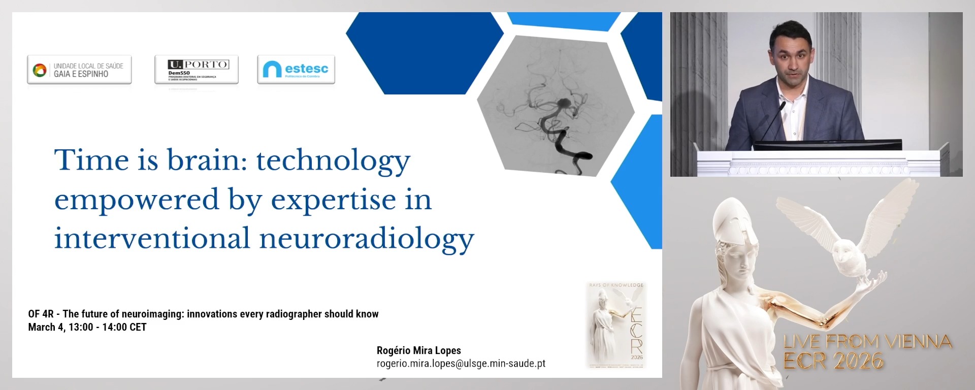Time is brain: technology empowered by expertise in interventional neuroradiology