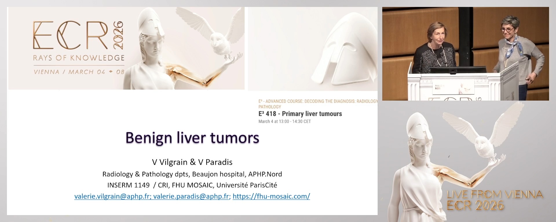 Benign liver tumours