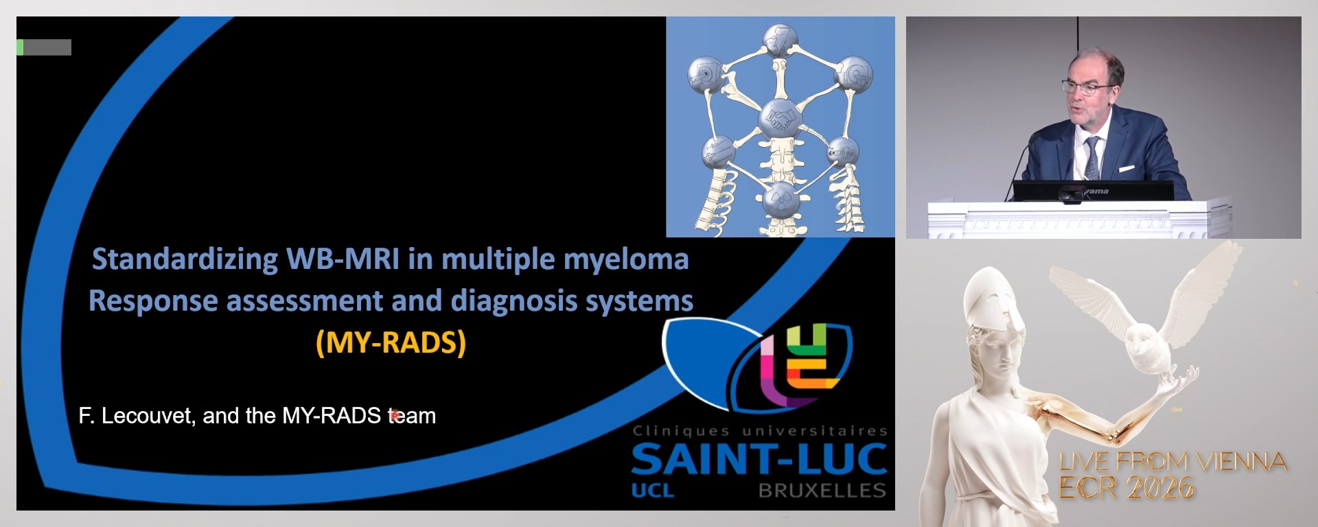 Myeloma response assessment and diagnosis systems (MY-RADS): standardising whole-body MRI assessment of multiple myeloma