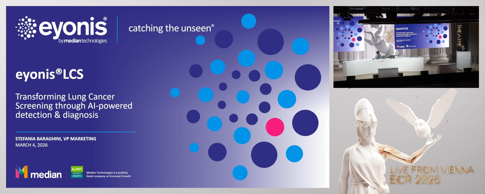 eyonis® LCS: redefining Lung Cancer Screening with AI