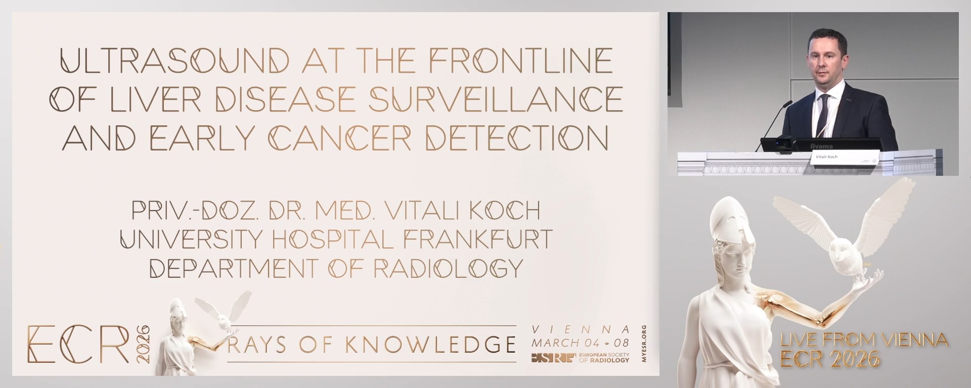 Ultrasound at the frontline in liver disease surveillance and early cancer detection