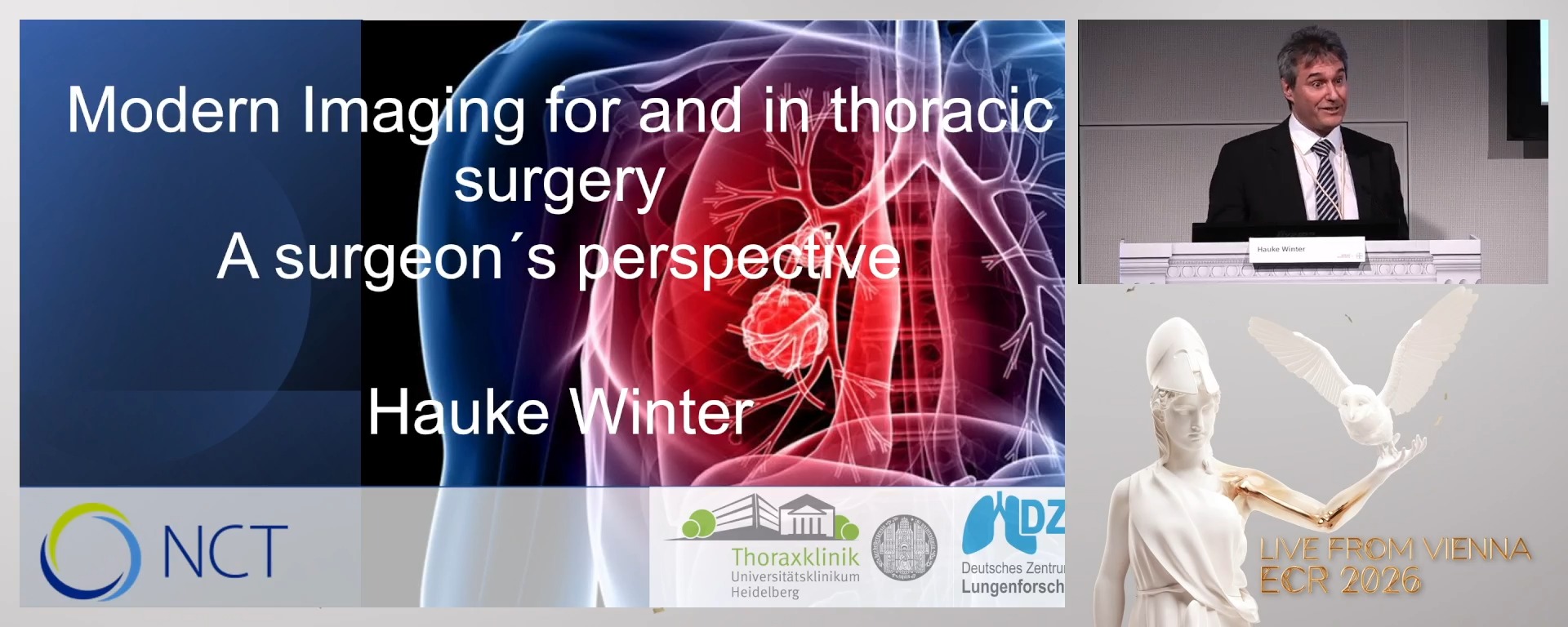 Modern Imaging for and in Thoracic Surgery – A Surgeon’s Perspective