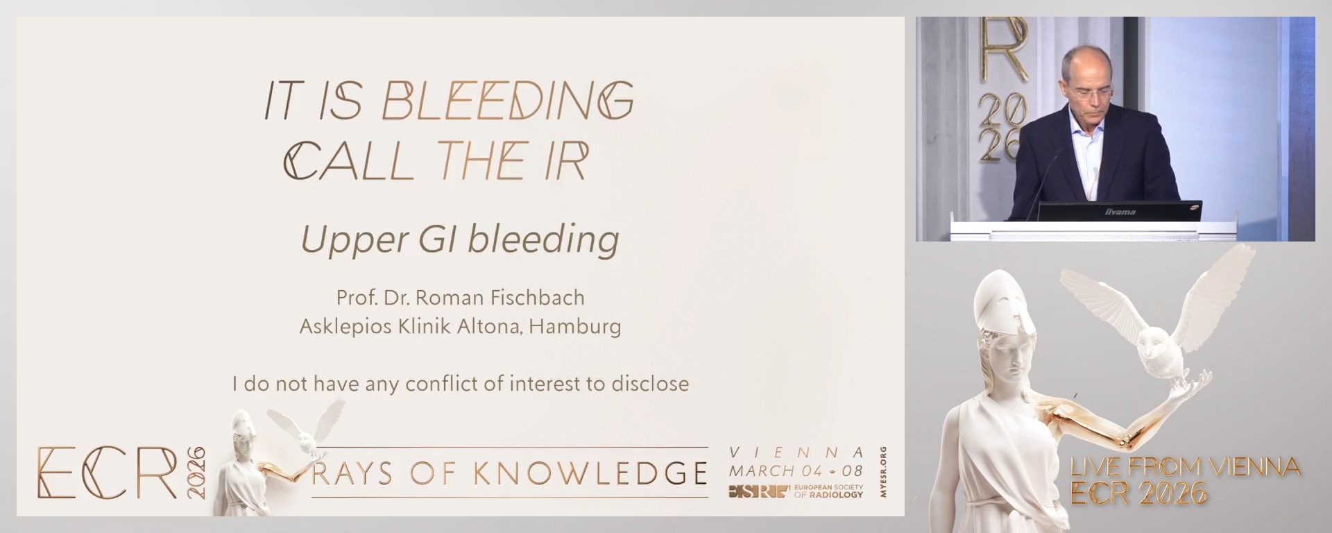 Upper GI bleeding