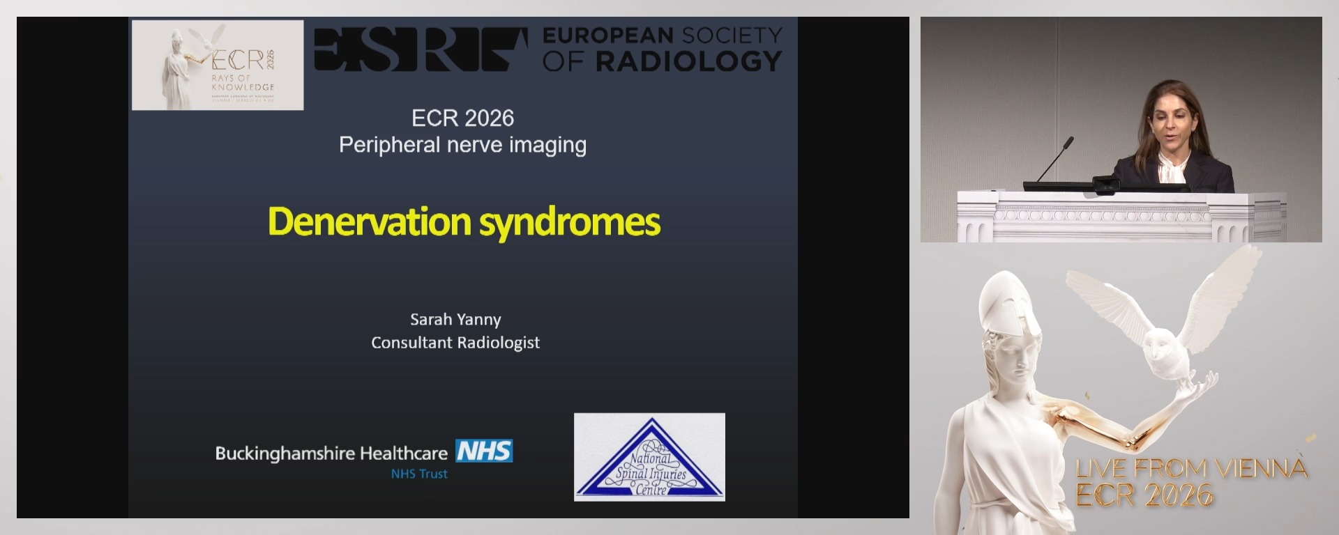 Denervation syndromes